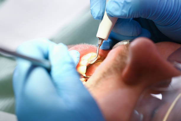 Best Emergency Denture Repair in Pana, IL