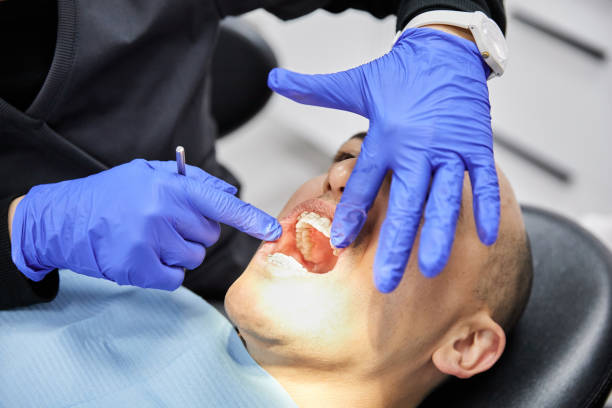 Best Emergency Dental Care for Sports Injuries in Pana, IL