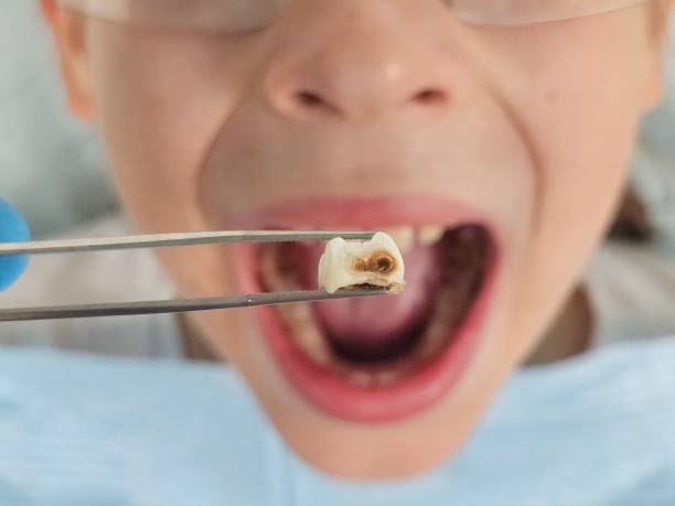 Best Emergency Cosmetic Dentistry (e.g., broken veneers) in Pana, IL